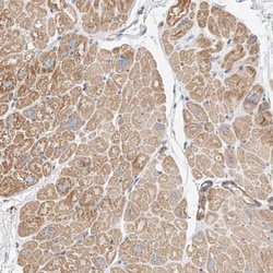 WFS1 Antibody, Novus Biologicals:Antibodies:Primary Antibodies